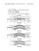 MEDICAL DEVICE diagram and image