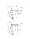 EXPANDABLE MEDICAL DEVICE AND METHOD diagram and image