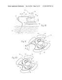 PORTABLE ASSEMBLIES, SYSTEMS AND METHODS FOR PROVIDING FUNCTIONAL OR     THERAPEUTIC NEUROSTIMULATION diagram and image