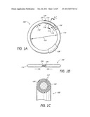 SELECTIVELY ADJUSTABLE CARDIAC VALVE IMPLANTS diagram and image