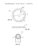 SELECTIVELY ADJUSTABLE CARDIAC VALVE IMPLANTS diagram and image