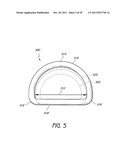 SELECTIVELY ADJUSTABLE CARDIAC VALVE IMPLANTS diagram and image