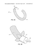 SELECTIVELY ADJUSTABLE CARDIAC VALVE IMPLANTS diagram and image