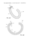 SELECTIVELY ADJUSTABLE CARDIAC VALVE IMPLANTS diagram and image