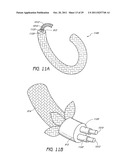 SELECTIVELY ADJUSTABLE CARDIAC VALVE IMPLANTS diagram and image