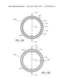 SELECTIVELY ADJUSTABLE CARDIAC VALVE IMPLANTS diagram and image