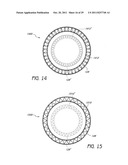 SELECTIVELY ADJUSTABLE CARDIAC VALVE IMPLANTS diagram and image