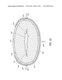 SELECTIVELY ADJUSTABLE CARDIAC VALVE IMPLANTS diagram and image