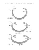 SELECTIVELY ADJUSTABLE CARDIAC VALVE IMPLANTS diagram and image