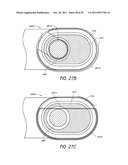 SELECTIVELY ADJUSTABLE CARDIAC VALVE IMPLANTS diagram and image