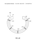 SELECTIVELY ADJUSTABLE CARDIAC VALVE IMPLANTS diagram and image