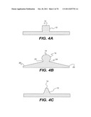 METHODS AND DEVICES FOR SPINAL DISC ANNULUS RECONSTRUCTION AND REPAIR diagram and image