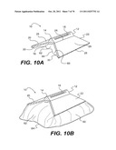 METHODS AND DEVICES FOR SPINAL DISC ANNULUS RECONSTRUCTION AND REPAIR diagram and image