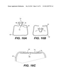 METHODS AND DEVICES FOR SPINAL DISC ANNULUS RECONSTRUCTION AND REPAIR diagram and image