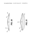 METHODS AND DEVICES FOR SPINAL DISC ANNULUS RECONSTRUCTION AND REPAIR diagram and image