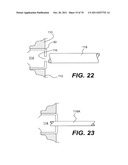 METHODS AND DEVICES FOR SPINAL DISC ANNULUS RECONSTRUCTION AND REPAIR diagram and image