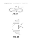 METHODS AND DEVICES FOR SPINAL DISC ANNULUS RECONSTRUCTION AND REPAIR diagram and image