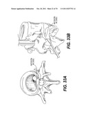 METHODS AND DEVICES FOR SPINAL DISC ANNULUS RECONSTRUCTION AND REPAIR diagram and image