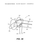 METHODS AND DEVICES FOR SPINAL DISC ANNULUS RECONSTRUCTION AND REPAIR diagram and image