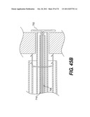 METHODS AND DEVICES FOR SPINAL DISC ANNULUS RECONSTRUCTION AND REPAIR diagram and image