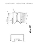 METHODS AND DEVICES FOR SPINAL DISC ANNULUS RECONSTRUCTION AND REPAIR diagram and image