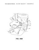 METHODS AND DEVICES FOR SPINAL DISC ANNULUS RECONSTRUCTION AND REPAIR diagram and image