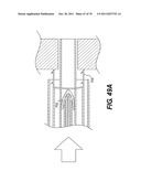 METHODS AND DEVICES FOR SPINAL DISC ANNULUS RECONSTRUCTION AND REPAIR diagram and image