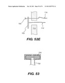 METHODS AND DEVICES FOR SPINAL DISC ANNULUS RECONSTRUCTION AND REPAIR diagram and image