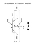 METHODS AND DEVICES FOR SPINAL DISC ANNULUS RECONSTRUCTION AND REPAIR diagram and image