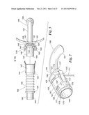 Ventilator to Tracheotomy Tube Coupling diagram and image