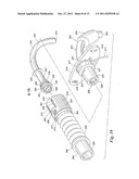 Ventilator to Tracheotomy Tube Coupling diagram and image