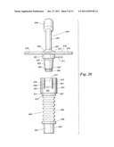 Ventilator to Tracheotomy Tube Coupling diagram and image