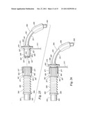 Ventilator to Tracheotomy Tube Coupling diagram and image