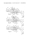 Ventilator to Tracheotomy Tube Coupling diagram and image