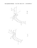 FORNIX MANIPULATOR diagram and image