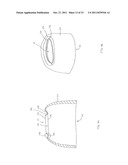 FORNIX MANIPULATOR diagram and image