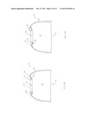 FORNIX MANIPULATOR diagram and image