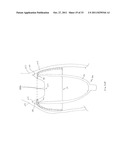 FORNIX MANIPULATOR diagram and image