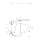 FORNIX MANIPULATOR diagram and image