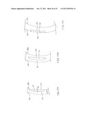 FORNIX MANIPULATOR diagram and image