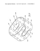 Spring damper diagram and image