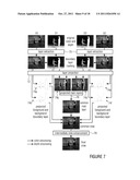 Intermediate View Synthesis and Multi-View Data Signal Extraction diagram and image