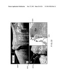 SYSTEMS, METHODS AND COMPUTER-ACCESSIBLE MEDIUM WHICH PROVIDE MICROSCOPIC     IMAGES OF AT LEAST ONE ANATOMICAL STRUCTURE AT A PARTICULAR RESOLUTION diagram and image