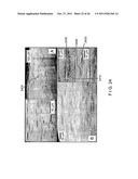 SYSTEMS, METHODS AND COMPUTER-ACCESSIBLE MEDIUM WHICH PROVIDE MICROSCOPIC     IMAGES OF AT LEAST ONE ANATOMICAL STRUCTURE AT A PARTICULAR RESOLUTION diagram and image