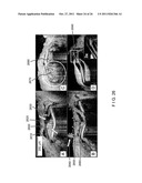 SYSTEMS, METHODS AND COMPUTER-ACCESSIBLE MEDIUM WHICH PROVIDE MICROSCOPIC     IMAGES OF AT LEAST ONE ANATOMICAL STRUCTURE AT A PARTICULAR RESOLUTION diagram and image