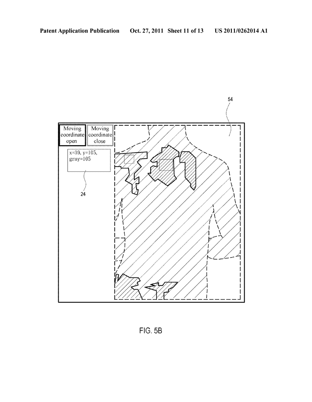 ABNORMAL SKIN AREA CALCULATING SYSTEM AND CALCULATING METHOD THEREOF - diagram, schematic, and image 12