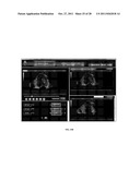 Automatic Cardiac Functional Assessment Using Ultrasonic Cardiac Images diagram and image