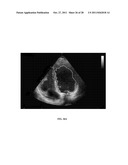 Automatic Cardiac Functional Assessment Using Ultrasonic Cardiac Images diagram and image