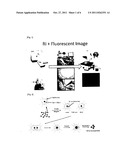 FLUORESCENT SILICA NANOPARTICLE WITH RADIOACTIVE TAG AND THE DETECTING     METHOD OF PET AND FLUORESCENT DUAL IMAGING USING THEREOF diagram and image