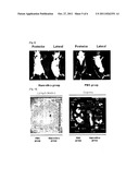 FLUORESCENT SILICA NANOPARTICLE WITH RADIOACTIVE TAG AND THE DETECTING     METHOD OF PET AND FLUORESCENT DUAL IMAGING USING THEREOF diagram and image